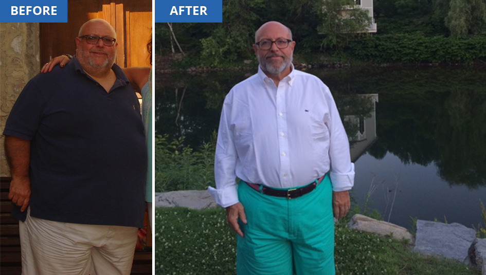 Photo of Gastric Sleeve Surgery Gave Me My Life Back