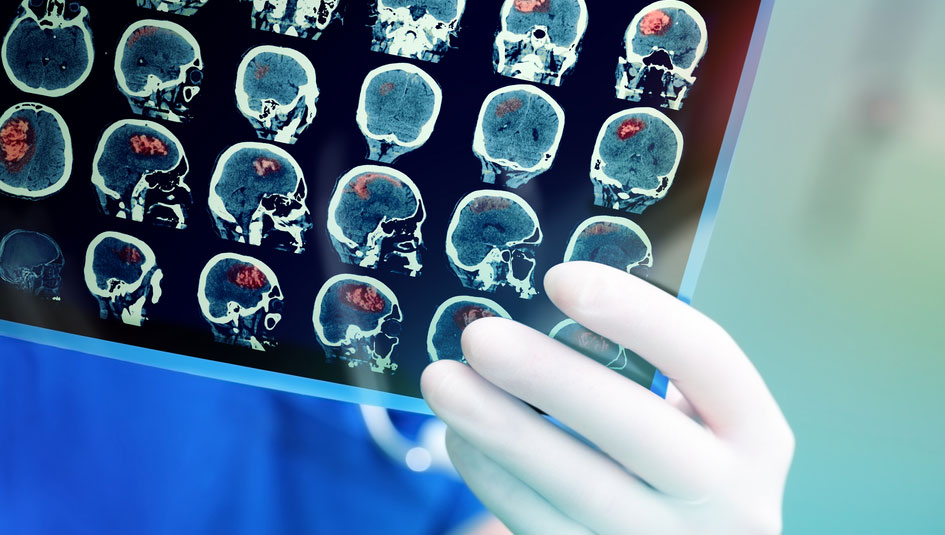 Photo of Metformin Deemed Safe for Most Medical Imaging