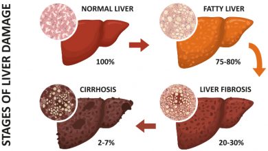 Photo of Investigational NASH Diagnostic Tool Could be a Game-Changer for the T2D Community