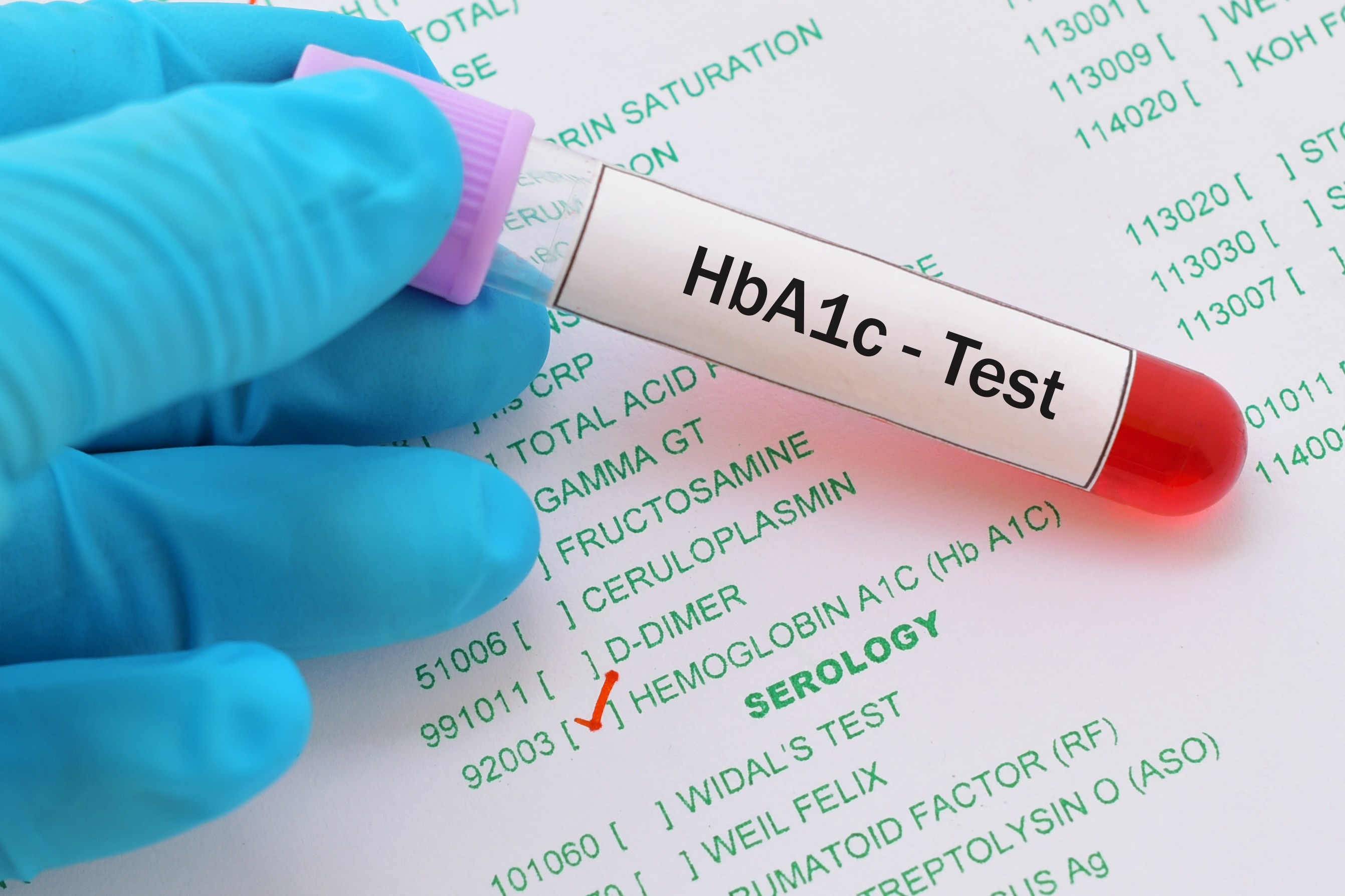 Hba1c And Blood Glucose Chart